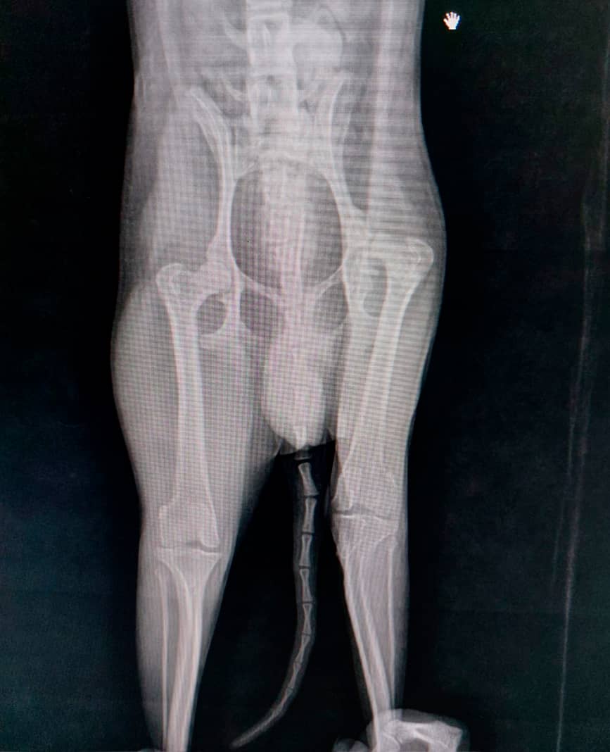 Luxación y displasia de cadera