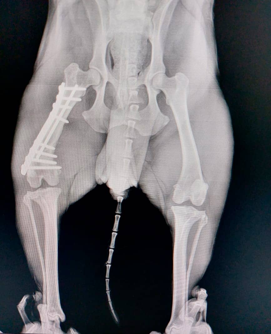 Fijación interna fractura femur